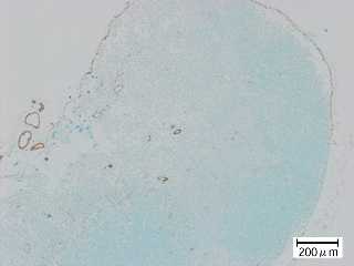 マウス・モノクローナル一次抗体とHRP標識-抗Mouse IgG二次抗体を用いた染色写真弱拡大