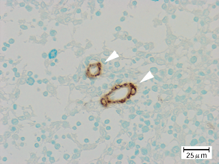 マウス・モノクローナル一次抗体とHRP標識-抗Mouse IgG二次抗体を用いた染色写真強拡大